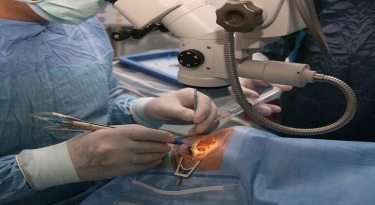 operacion-de-ojos-1-750x410