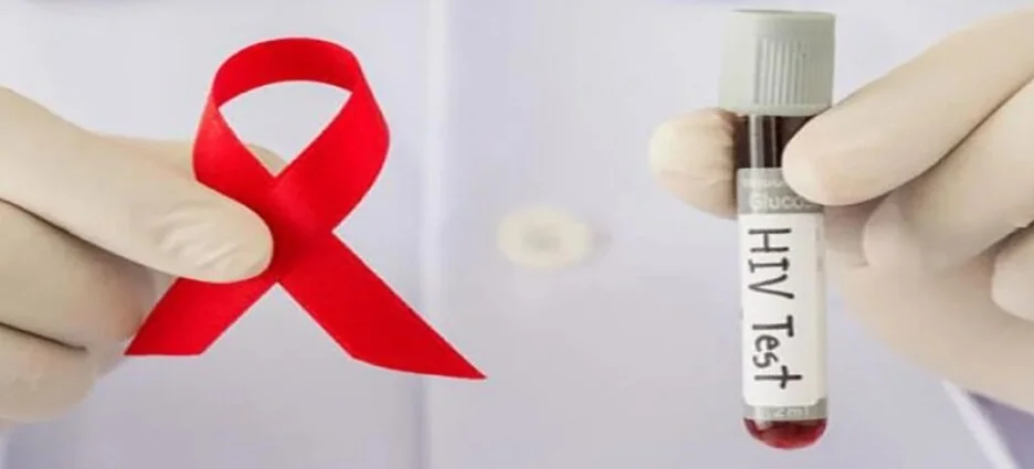 Sinaloa refuerza el llamado a la prevención del VIH