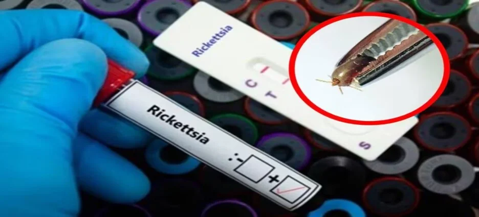 Se han registrado 10 muertes por rickettsia en Baja California en lo que va de 2026