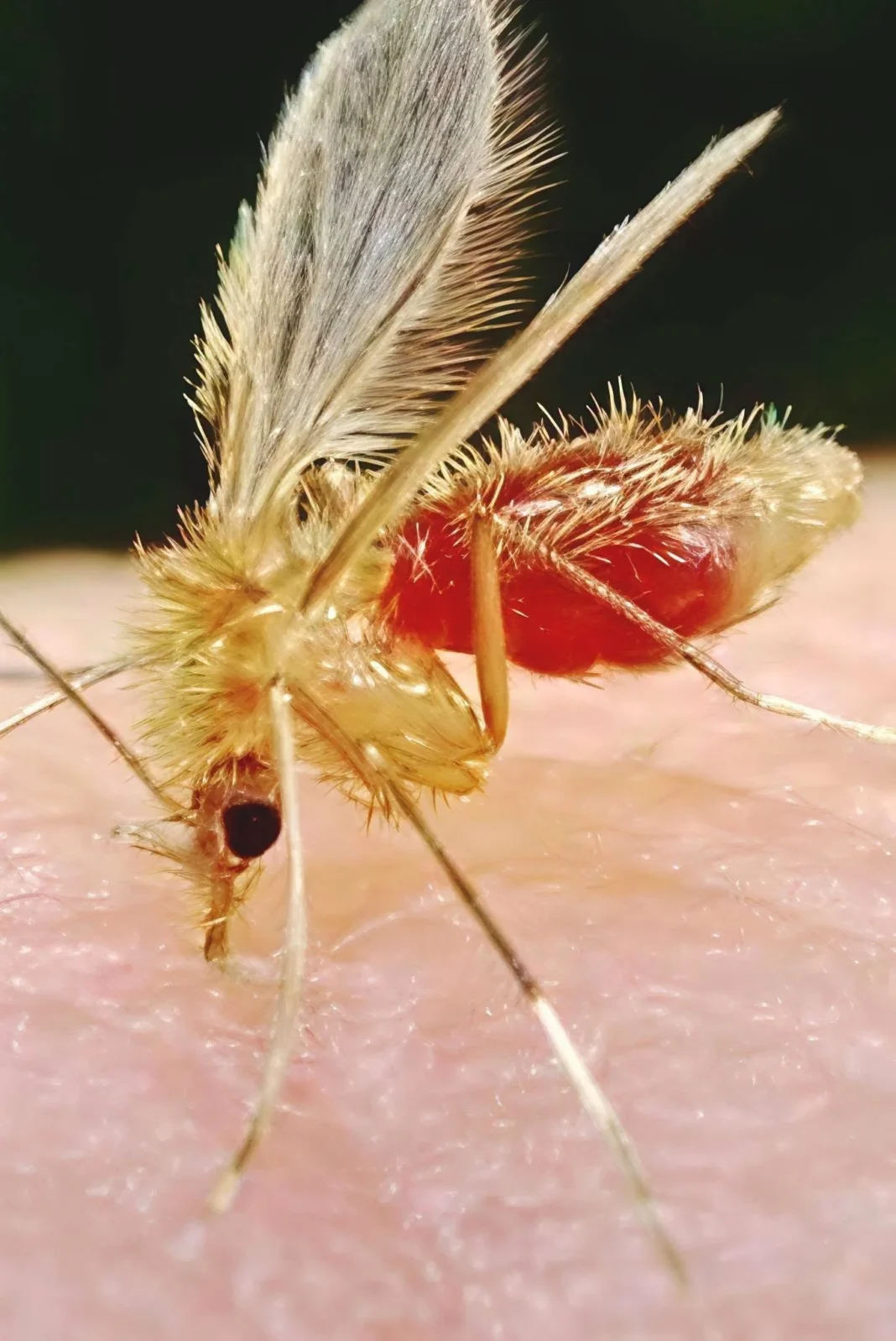Leishmaniasis